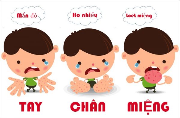 Nhận biết sớm bệnh tay – chân – miệng