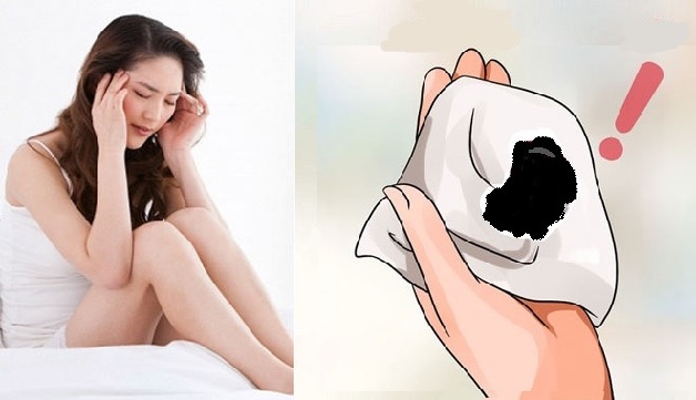 Ra máu đen khi mang thai là hiện tượng khiến nhiều mẹ bầu cảm thấy hoang mang, lo lắng
