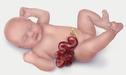 Bệnh có thể xảy ra ở cả người lớn và trẻ em
