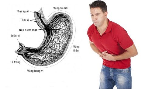 Khi thấy xuất hiện các triệu chứng nghi mắc bệnh ở dạ dày cần tiến hành nội soi để chẩn đoán chính xác bệnh