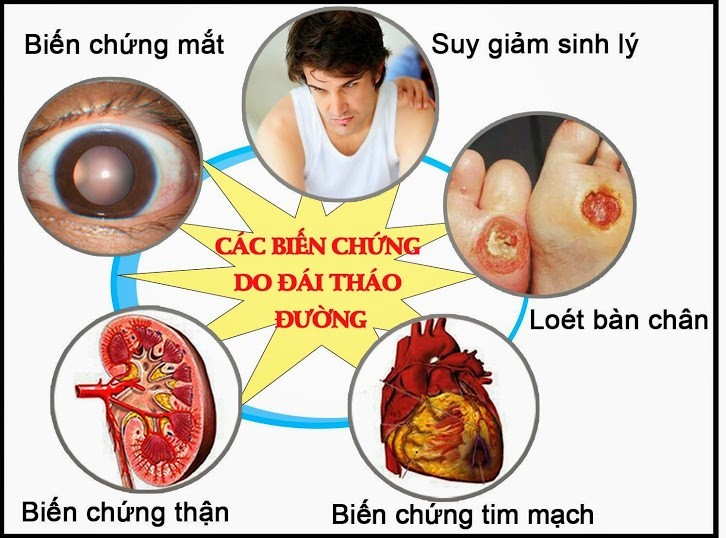 Phòng biến chứng cho người bệnh tiểu đường