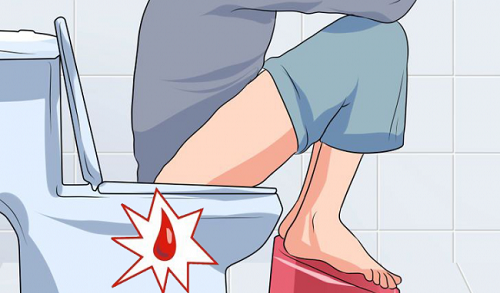 Khi bị viêm trực tràng, người bệnh sẽ thấy xuất hiện các triệu chứng đi ngoài ra máu, đau chướng bụng...