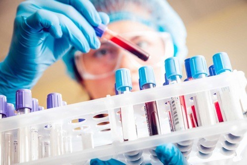 Xét nghiệm máu chẩn đoán nhóm máu ABO cần thực hiện càng sớm càng tốt