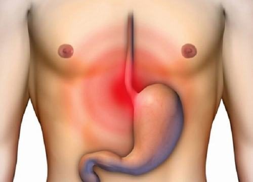 Đau thượng vị dạ dày là triệu chứng thường gặp khi mắc các bệnh về dạ dày