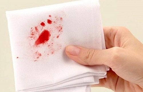 Người bệnh còn bị nôn ra máu khi bị ung thư dạ dày