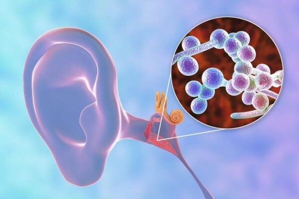 Virus, vi khuẩn xâm nhập và làm tổn thương cấu trúc tai, gây ra tình trạng viêm nhiễm
