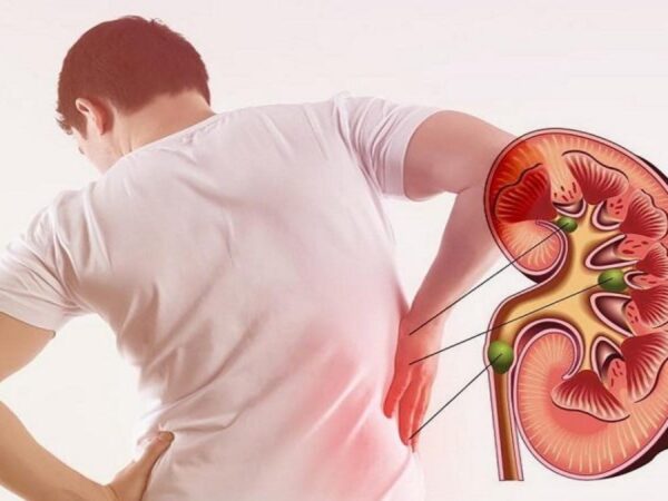 Uống nhiều nước có tác dụng gì? - Tốt cho thận
