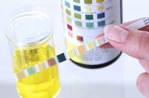 Bạch cầu trong nước tiểu cao khi mang thai