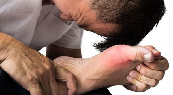 Những cơn đau do gout có thể từ nhẹ đến nặng, từ thưa đến mau,...