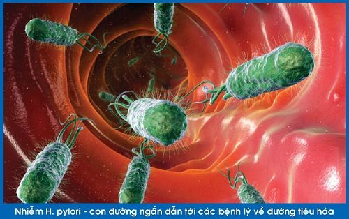 Vi khuẩn HP là loại vi khuẩn thường gặp trong niêm mạc dạ dày.