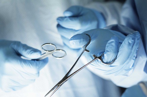 Phẫu thuật cắt polyp hậu môn là chỉ định cần thiết trong chẩn đoán và điều trị bệnh polyp hậu môn hiệu quả
