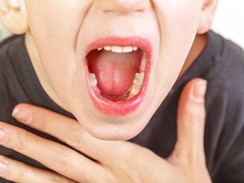 Viêm amidan khiến người bệnh bị đau họng khó nói, khó nuốt