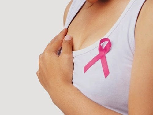 Ung thư vú giai đoạn 1 là gì? Ung thư vú là bệnh lý ác tính bắt nguồn tại vú.
