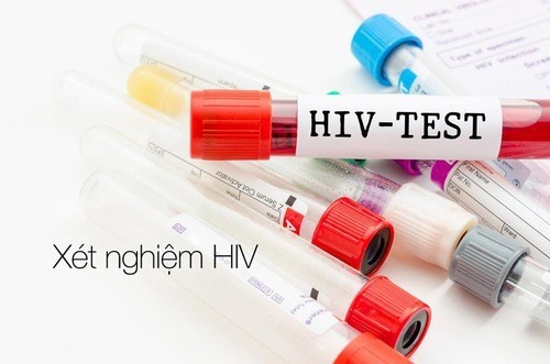 HIV là chỉ định cần thiết, do đó xét nghiệm hiv mất bao nhiêu tiền được nhiều người quan tâm