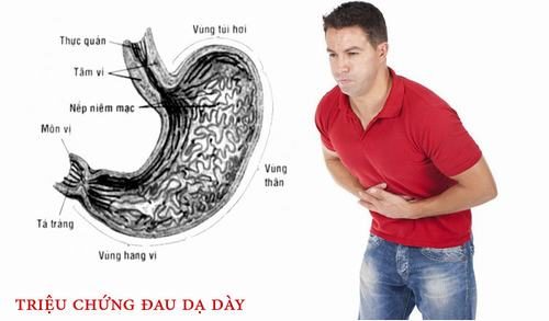 Đau bụng cũng có thể cảnh báo đau dạ dày