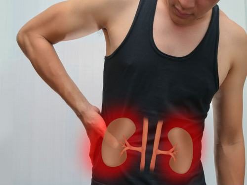 Người mắc bệnh sỏi thận cũng có thể gặp phải tình trạng đau bụng dưới