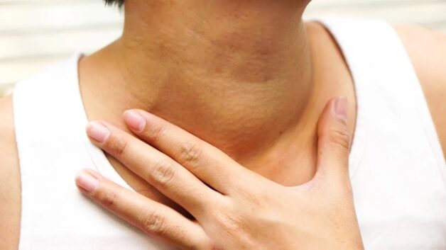 Dấu hiệu bệnh ung thư tuyến giáp ở giai đoạn II