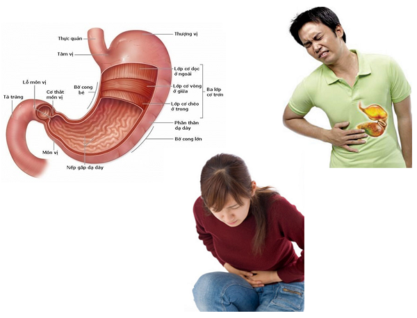 Khi mắc bệnh ở dạ dày - tá tràng cũng khiến người bệnh đau vùng trên rốn