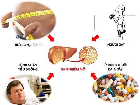 Gan nhiễm mỡ có thể do nhiều nguyên nhân gây nên cần được phát hiện sớm và điều trị hiệu quả