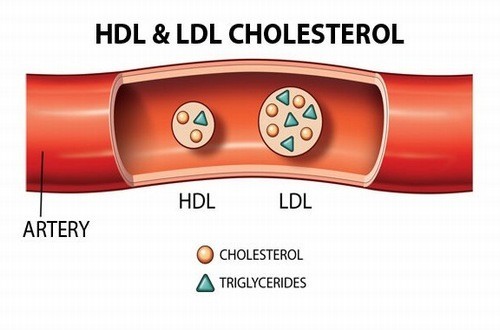 Kiểm soát lượng cholesterol trong cơ thể giúp ngừa biến chứng động mạch vành