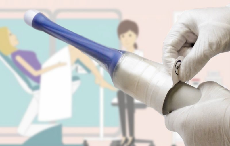 Siêu âm đầu dò có ảnh hưởng đến thai nhi không là câu hỏi được nhiều mẹ bầu quan tâm
