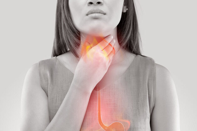 Trào ngược dạ dày dễ nhầm lẫm với tình trạng sinh lý thông thường nên dễ bị bỏ quên.