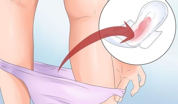 Xuất huyết âm đạo bất thường là một trong những triệu chứng thường gặp ở bệnh nhân ung thư cổ tử cung