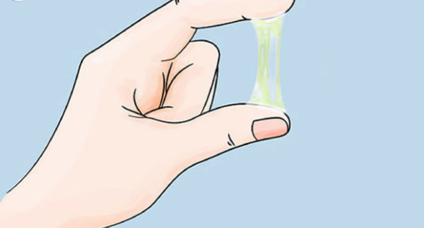 Dịch âm đạo bất thường là một trong những biểu hiện viêm lộ tuyến thường gặp