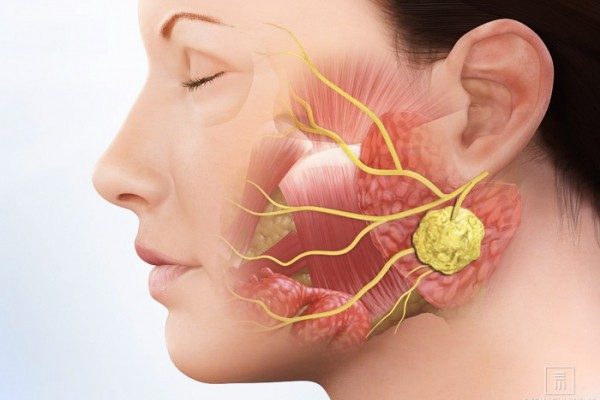 Ung thư ở vùng đầu cổ có những loại nào
