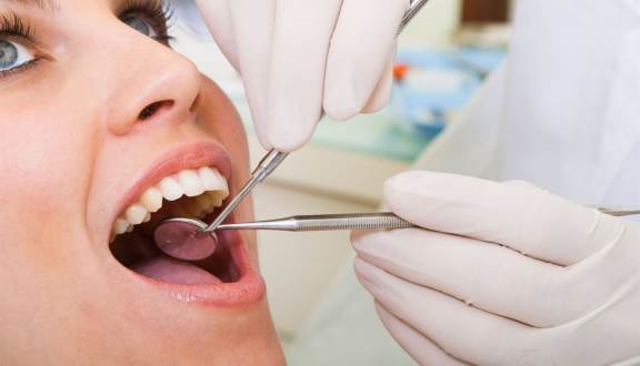 Lấy cao răng định kỳ 6 tháng/1 lần sẽ giúp phòng ngừa bệnh nướu răng