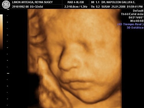 Với siêu âm thai 4D, bạn sẽ có cơ hội ngắm nhìn và chứng kiến sự phát triển của bé yêu trong bụng mẹ, trải nghiệm những cảm xúc khó quên trong những khoảnh khắc tuyệt vời.