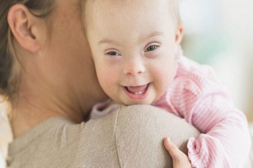 Độ mờ da gáy cao là một trong những cảnh báo về khả năng thai mắc nguy cơ hội chứng Down khi sinh ra.