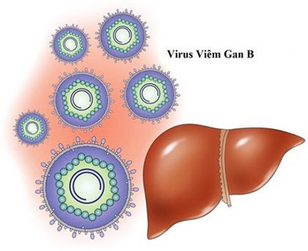 Bệnh viêm gan B là do nhiễm siêu vi viêm gan B  (Hepatitis B Virus viết tắt là HBV) tấn công  lá gan có thể gây viêm gan cấp tính và mạn tính