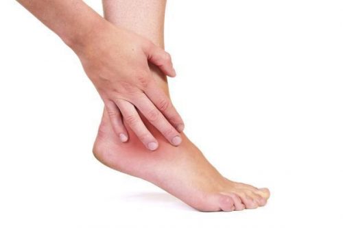 Mắt cá chân bị sưng khi mẹ mang thai