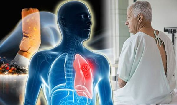 Dù điều trị bằng phương pháp nào, người bệnh cũng có thể gặp phải một số tác dụng phụ không mong muốn