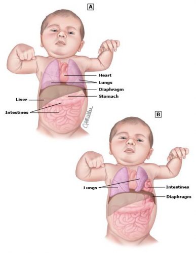 Để biết thêm thông tin chi tiết hoặc cần giải đáp thêm về thoát vị cơ hoành ở thai nhi, bạn đọc vui lòng liên hệ với Bệnh viện Đa khoa Quốc tế Thu Cúc  theo số điện thoại 024.383.55555 hoặc 1900 558892 hoặc hotline: 0936 388 288.