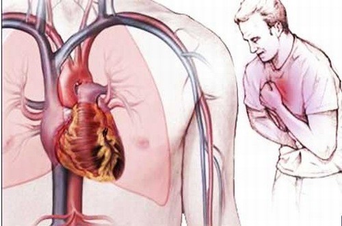 Chỉ số ure trong máu tăng có thể là dấu hiệu cảnh báo bệnh tim mạch