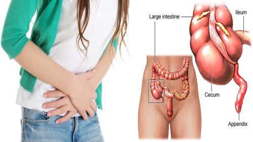 Viêm phúc mạc là bệnh nguy hiểm, nếu không phát hiện sớm và điều trị kịp thời, đúng cách có thể đe dọa đến tính mạng của người bệnh.