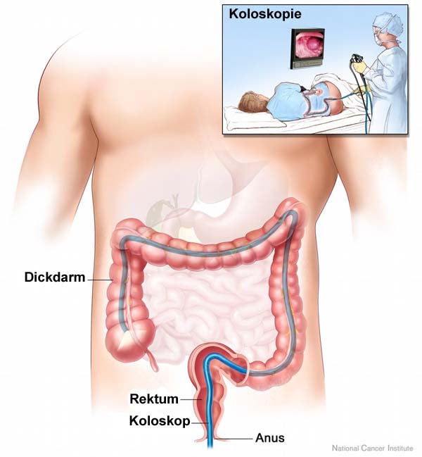 •Soi trực tràng cho phép phát hiện các tổn thương của trực tràng và đoạn đại tràng xích ma