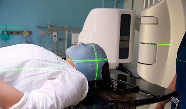 xạ trị ung thư đại tràng