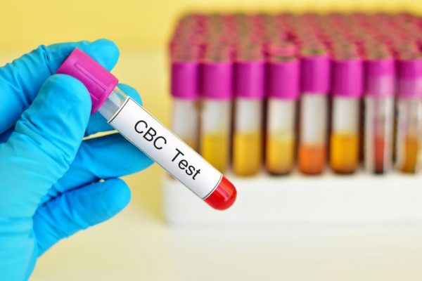 Xét nghiệm công thức máu toàn phần
