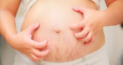 bị ngứa khi mang thai tháng cuối