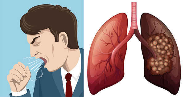 Các biểu hiện bệnh ung thư phổi thường chỉ xuất hiện ở giai đoạn muộn