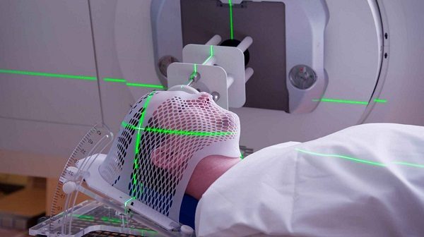 Xạ trị là một trong những phương pháp điều trị chính cho bệnh nhân ung thư vòm họng