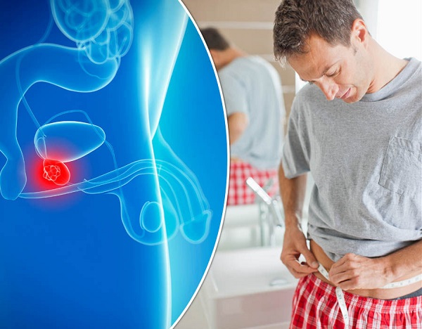 PSA tăng cao ở nhiều bệnh nhân ung thư tuyến tiền liệt