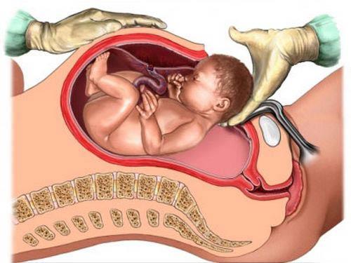 Bác sĩ mổ đẻ chuyên môn cao – lựa chọn an tâm của nhiều mẹ bầu sinh mổ