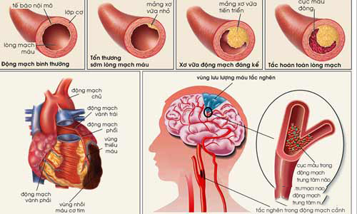 Tổng hợp thông tin về 