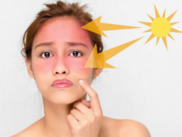 Tránh tiếp xúc trực tiếp với nắng mặt trời ở cường độ cao là cách hiệu quả giúp ngăn ngừa ung thư da