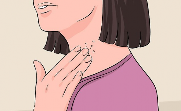 Điều trị buồng trứng đa nang thế nào