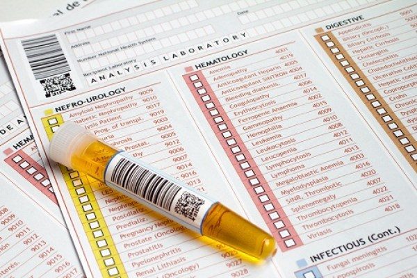 Một số bệnh lý khiến chỉ số bạch cầu cao trong nước tiểu